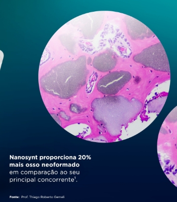 Corte histológico — neoformação óssea com Nanosynt
